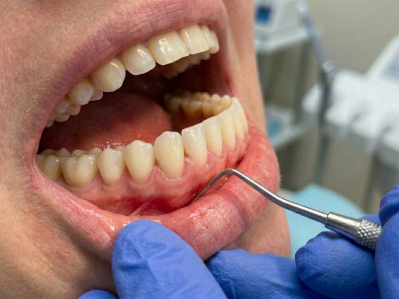 Consultez-vous assez tôt un cabinet de parodontologie au nord de Lyon pour traiter une gingivite avant aggravation ?