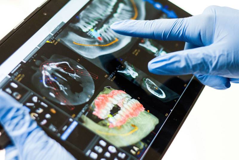 scanner CBCT offrant des images 3D précises pour une évaluation détaillée de vos besoins près de Chalon-sur-Saône