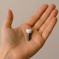 Notre zone d'activité pour ce service Rendez-vous chez un dentiste pour un détartrage