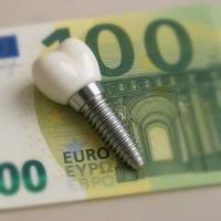 Notre zone d'activité pour ce service Prix et tarif pour comblement sinus et greffe osseuse