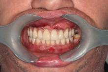 Nos prestations sur le secteur de près de Lyon 69 Rhône