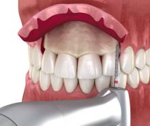 Notre zone d'activité pour ce service Comblement sinus et greffe osseuse par chirurgien dentiste compétent