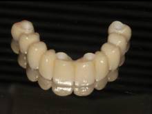 Notre zone d'activité pour ce service Dentiste à près de Lyon 69 Rhône pour devis implant dentaire