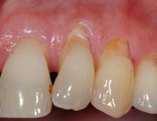 Notre zone d'activité pour ce service Comblement sinus et greffe osseuse par chirurgien dentiste compétent