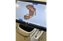 Notre zone d'activité pour ce service Prix et tarif pour comblement sinus et greffe osseuse