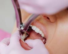 Notre zone d'activité pour ce service Mise en charge immédiate d'implant dentaire par experts