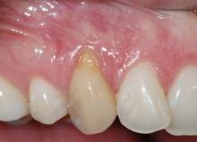 Notre zone d'activité pour ce service Prise en charge de parodontite et inflammation de la gencive